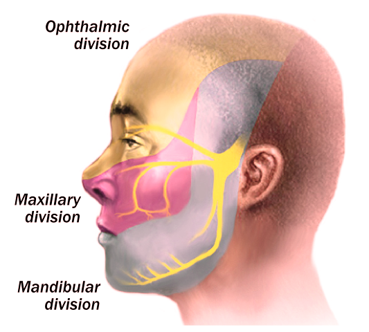 Trigeminal neuralgia treatment Vitality Chiropractic