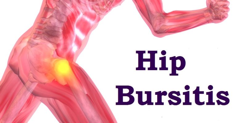 Bursitis | Causes, Symptoms, Treatment | Vitality Chiropractic Australia